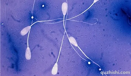 如何判断自己的精子质量?