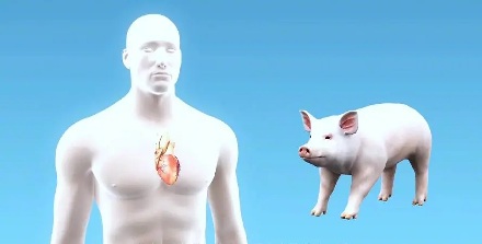 猪的心脏为啥能给人用？