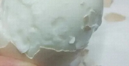 为啥有些日煮蛋剥起来坑坑洼洼的?