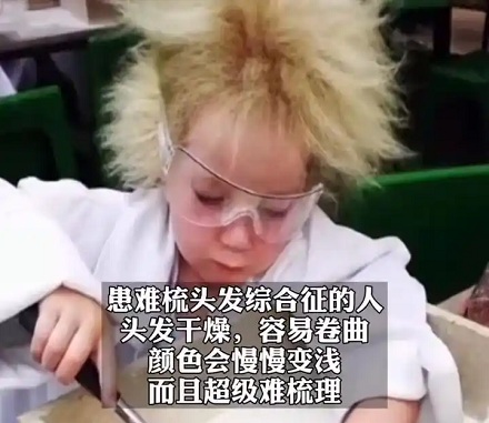 为什么爱因斯坦的头发总是乱糟糟的?