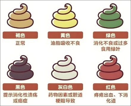 为什么拉完便便要回头看一眼？