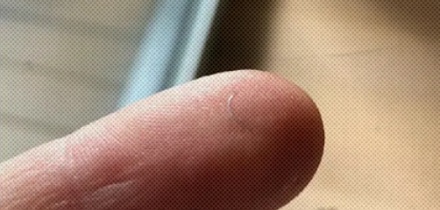 为什么手术中护士最怕听到主刀医生说 10-0 的针掉了？