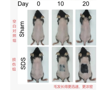 为什么伤口愈合后会长毛？那头皮受伤也能生发吗？