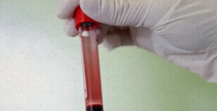 为什么每次住院都要查血型，人的血型不是不会变吗？