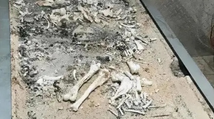 牙齿是最硬的器官，为啥遗体火化后只剩骨头，没有牙齿？