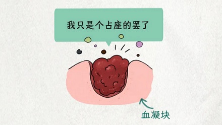 为什么拔牙后不出血，反而更危险？