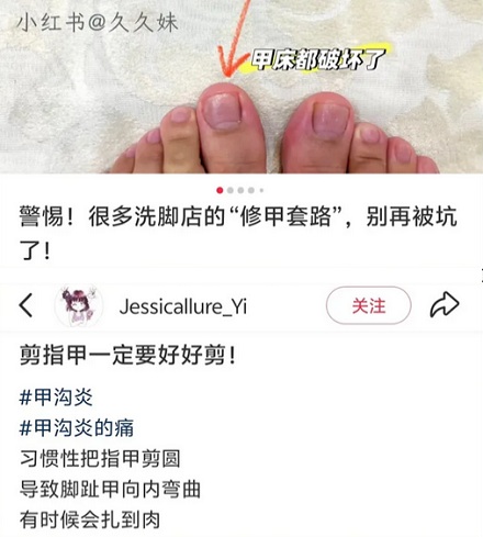 为什么千万不要把指甲剪成圆弧形？